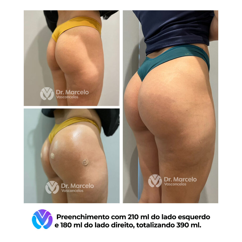 Resultado-Dr-Marcelo-Vasconcelos-2.jpg