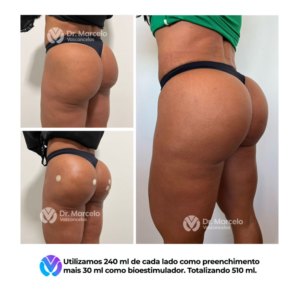 Resultado-Dr-Marcelo-Vasconcelos-4.jpg